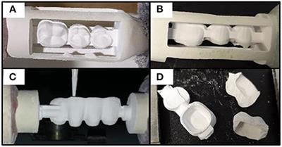 Monolith Dental Bridge by Soft Machining of Dried Ceramic Dough